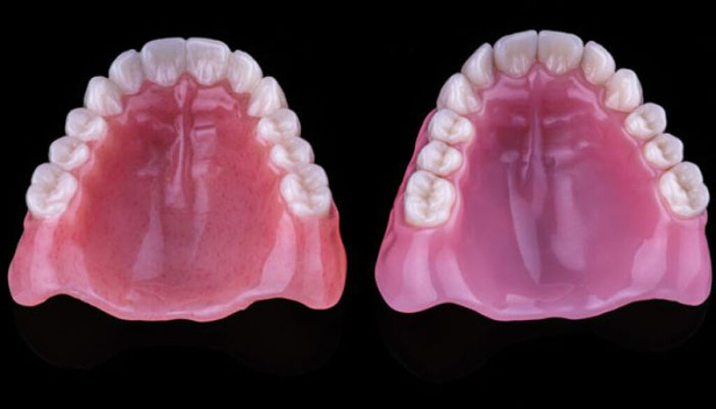 پرینت سه بعدی در دندانپزشکی - اینوفب