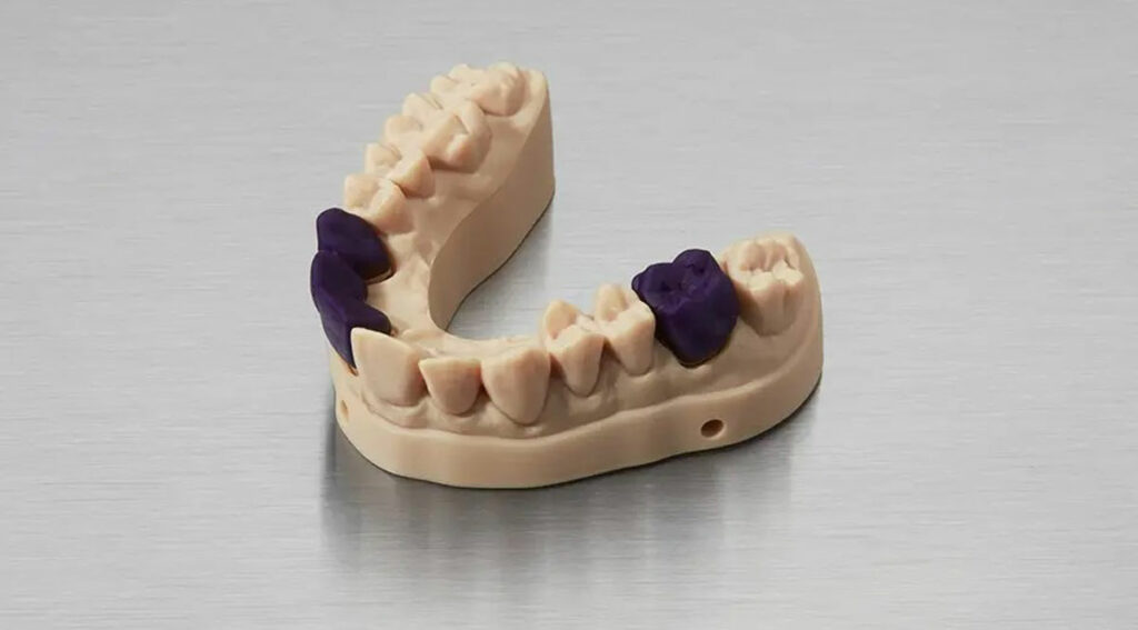پرینت سه بعدی دندان-اینوفب